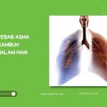Artikel Kesehatan Mengungkap Kebiasaan Sehari Hari Penyebab Asma Yang Perlu Diwaspadai