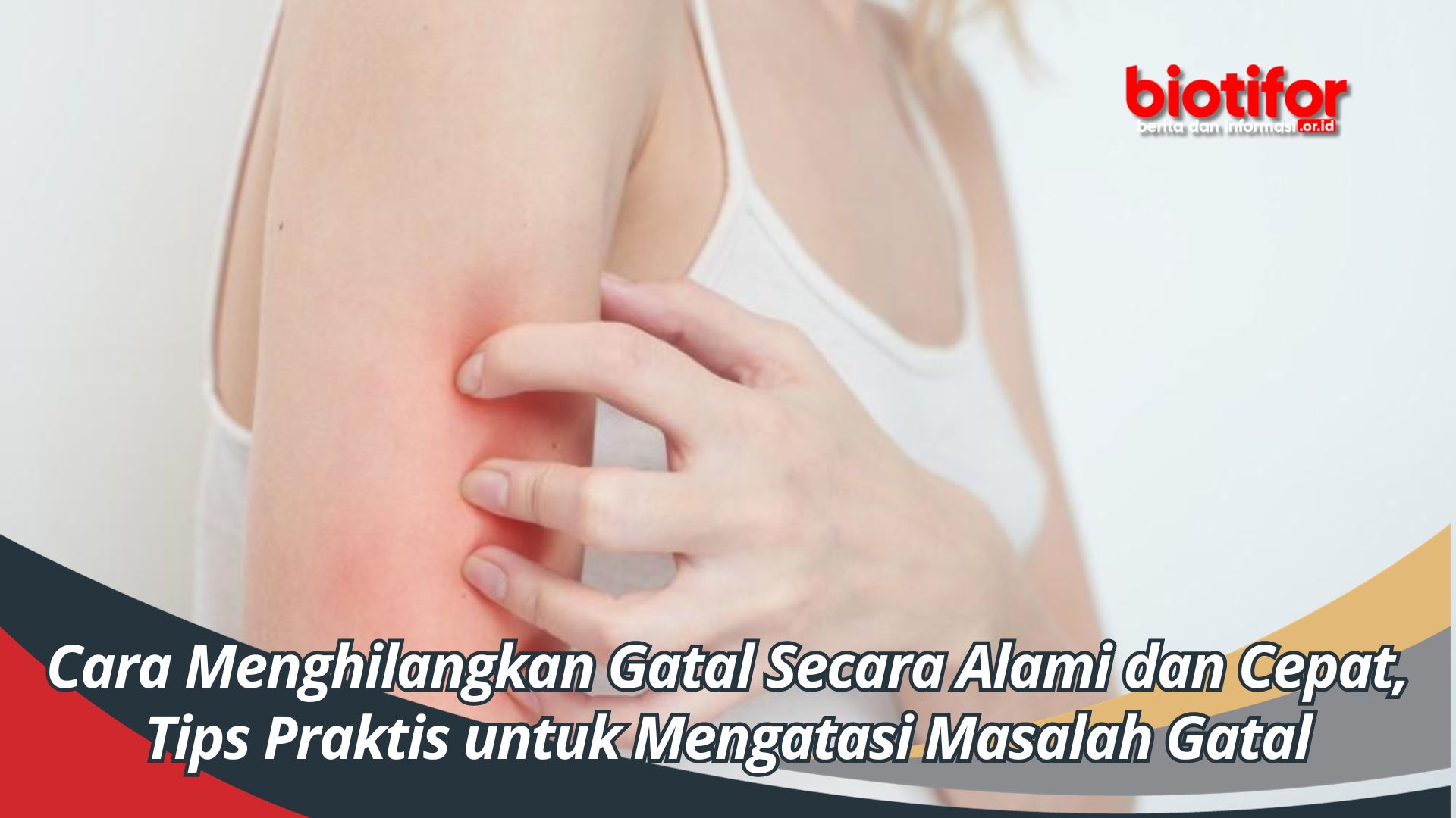 Cara Mengatasi Kulit Gatal Secara Alami Panduan Lengkap Untuk Kenyamanan Optimal