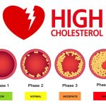 Dampak Kolesterol Tinggi Jika Tidak Ditangani Ancaman Serius Bagi Kesehatan Jangka Panjang